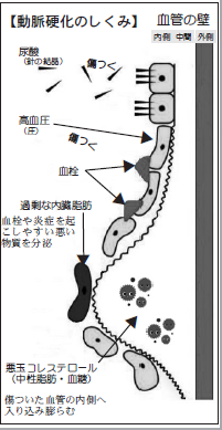 挿絵2